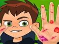 游戏Ben10手形医生 在线