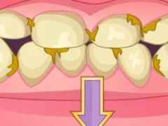 游戏Bad Teeth Makeover在线