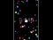 游戏Pop Ball在线