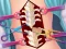 游戏Anna Scoliosis Surgery在线