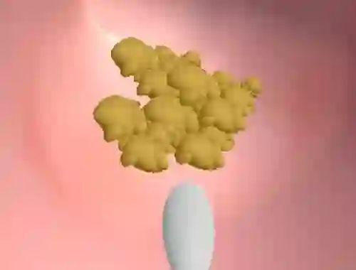 游戏Earwax Clinic在线