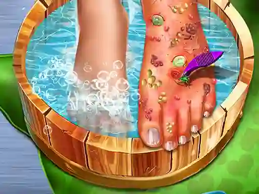 游戏Feet Skin Doctor在线