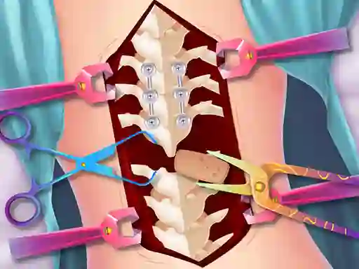 游戏Anna Scoliosis Surgery在线