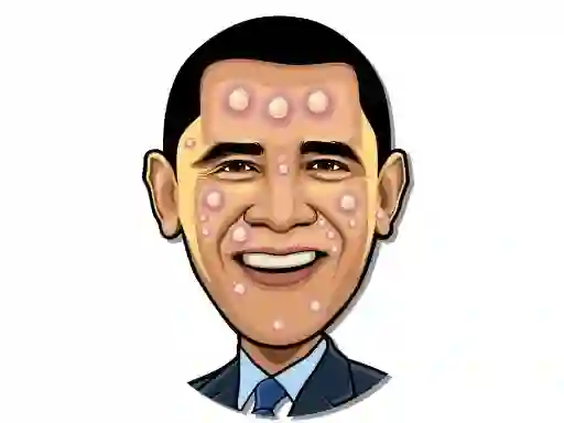 游戏Celebrity Pimple Pop在线