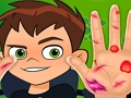 游戏Ben10手形医生 在线